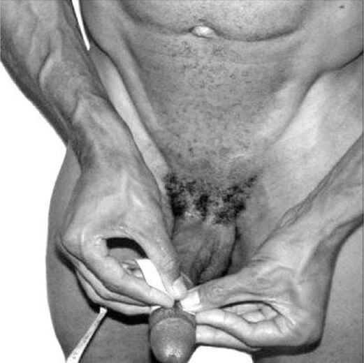 pomiar penisa przed powiększeniem