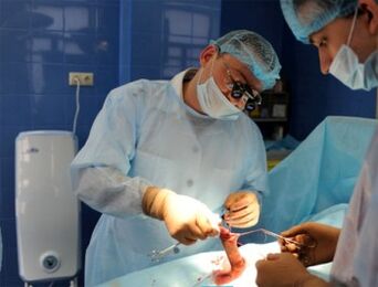 Operacja powiększania prącia wykonywana przez chirurgów